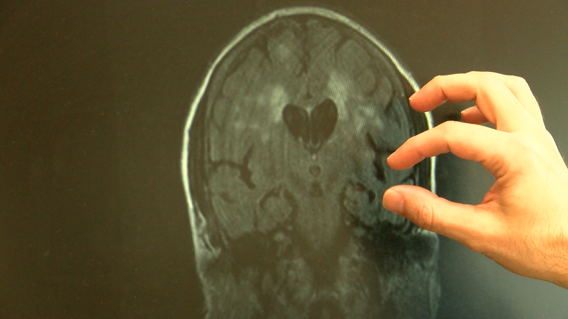 ALZHEIMER'S _1475101571727.jpg