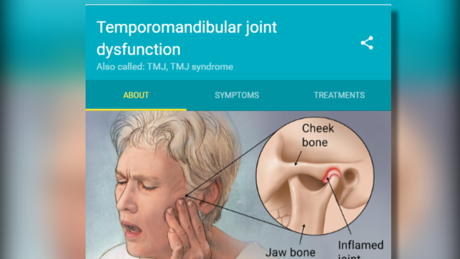 TMJ PIC_1485381824789.jpg