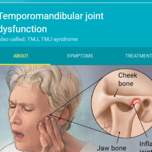 TMJ PIC_1485381824789.jpg