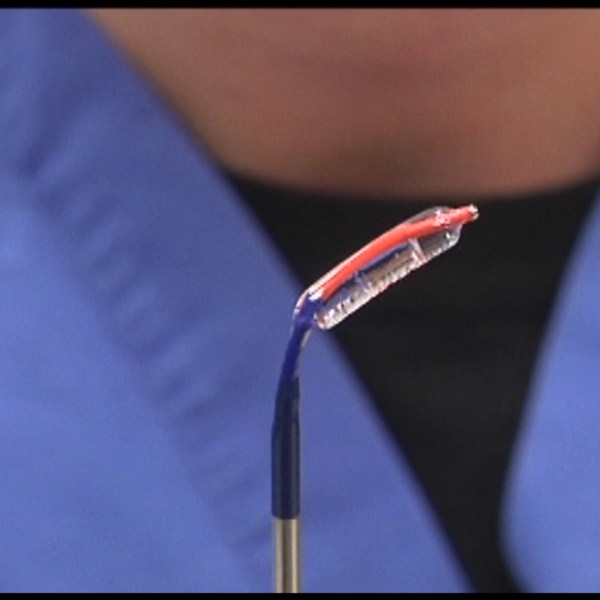 sinuplasty pic 2_1484774425294.jpg